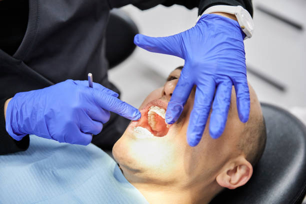 Best Dentist for Dental Trauma  in Aragon, GA