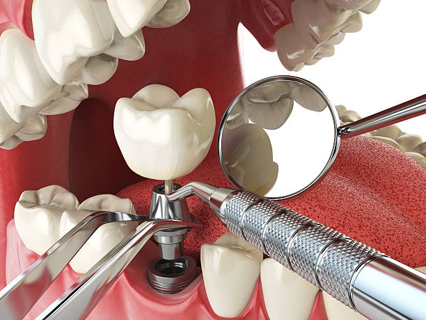 Best Broken Tooth Emergency  in Aragon, GA